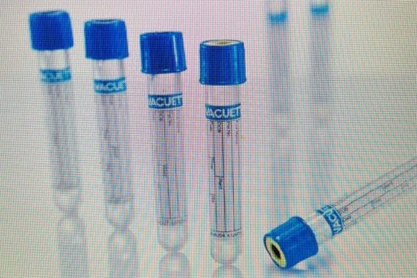 ⁦VACUETTE® TUBE 2 ml 9NC Coagulation sodium citrate 3.2%⁩ – תמונה ⁦3⁩